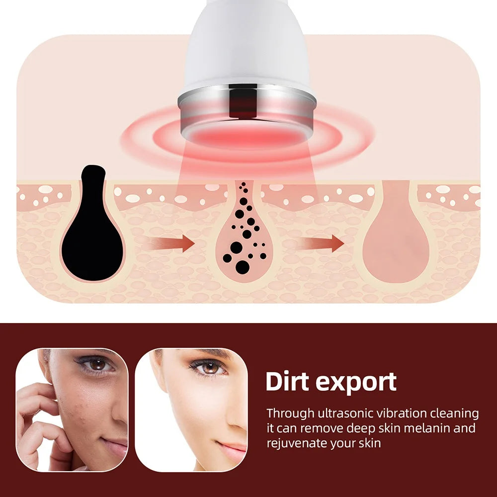 Ultrasonic Face & Eye Massager – Lifting, Firming & Skin Care Device