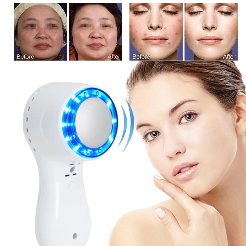 Blue Light Cryo Facial Massager – Cold Therapy & Skin Lifting Device
