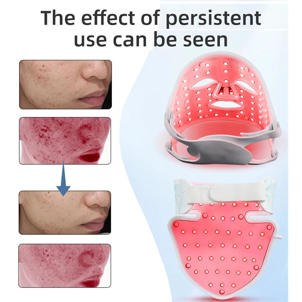 LED Facial and Neck Photon Mask for Skin Firming Whitening and Oil Control