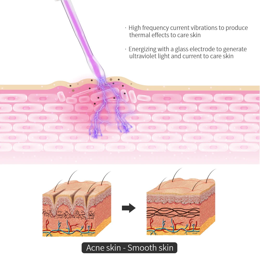 4-in-1 High Frequency Facial Wand – Acne, Skin Rejuvenation & SPA Care