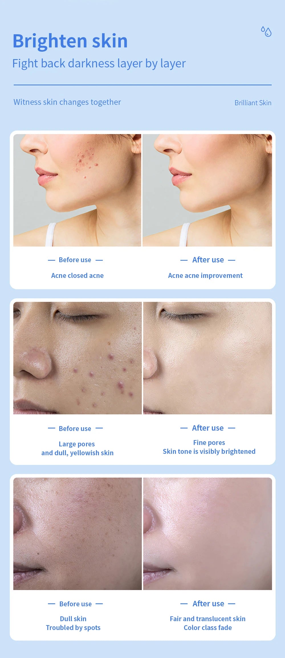 Blue Light Cryo Facial Massager – Cold Therapy & Skin Lifting Device