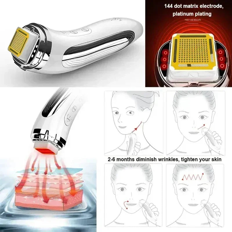 RF Face Lifting Device – Dot Matrix Beauty Massager for Wrinkle Removal & Skin Tightening