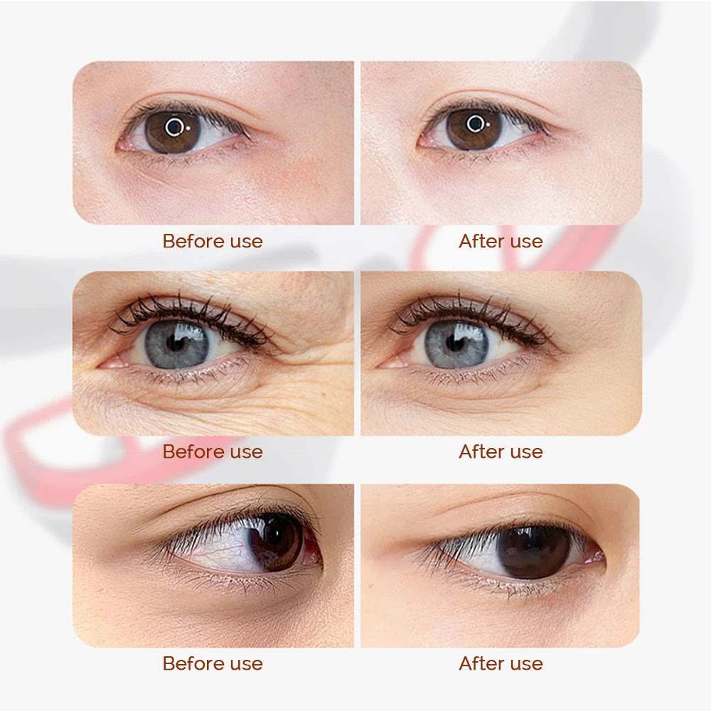 Professional Wireless Eye Massager with Red Light and Heat Therapy